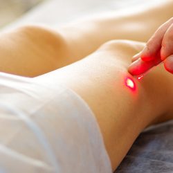 Cirurgia de Varizes a Laser
