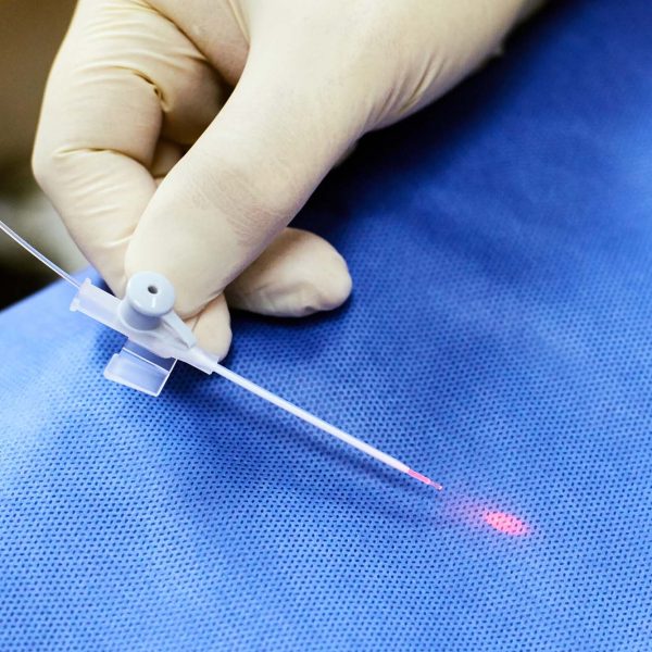 Mini Cirurgia de Varizes a Laser